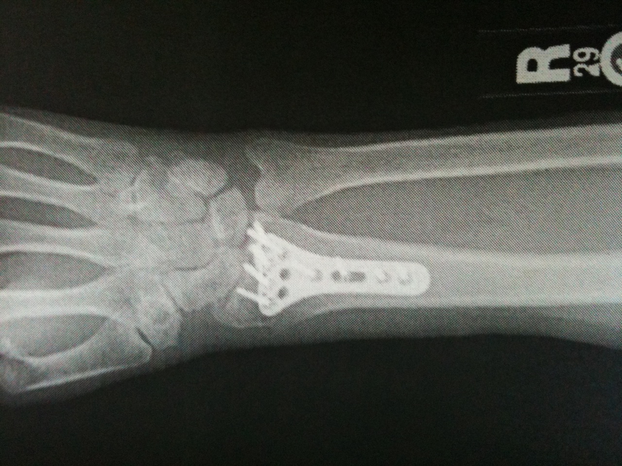 work-hand.JPG