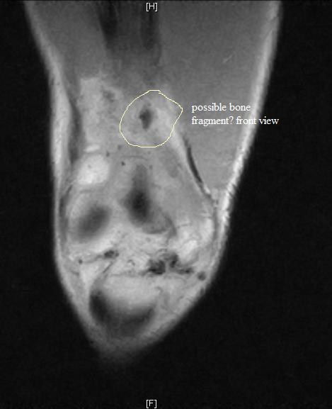 work-bone%2520front.jpg