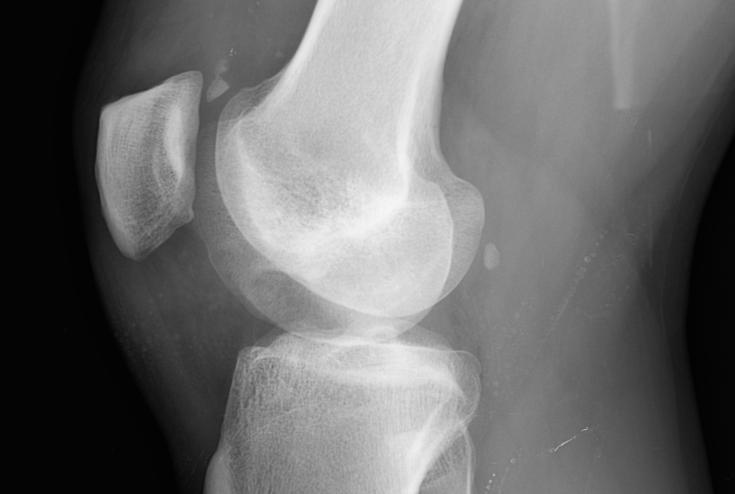 work-xray.jpg
