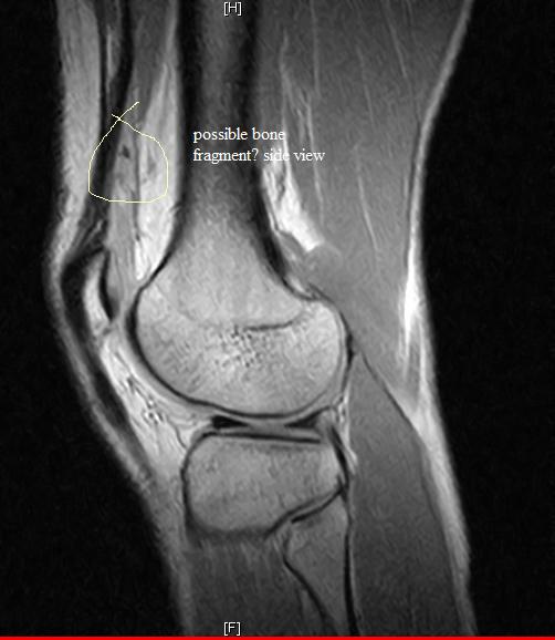 work-bone%2520side.jpg