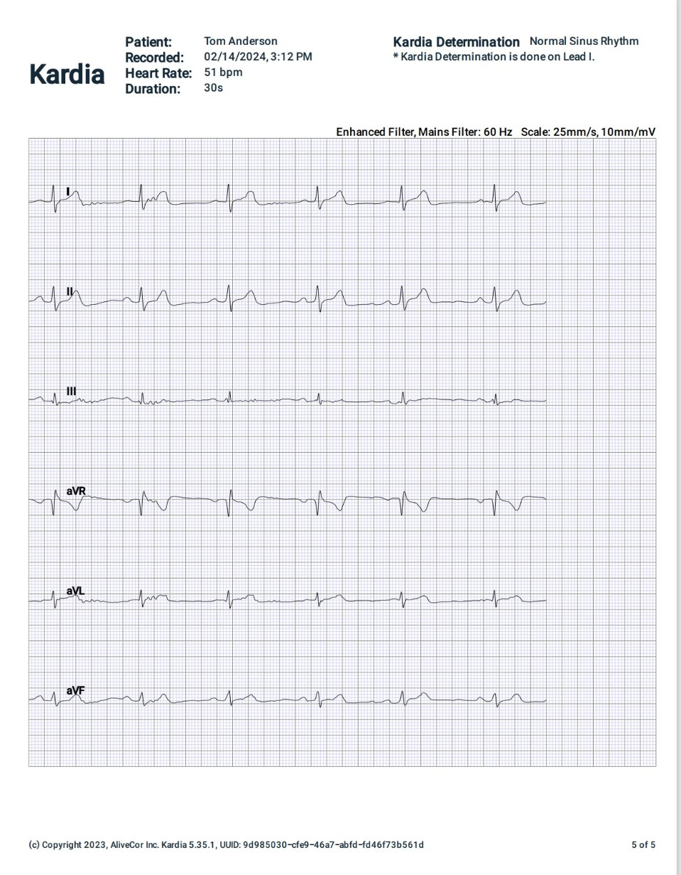 T. Anderson EKG 2-14-24.jpg