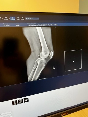 knee_one.jpg