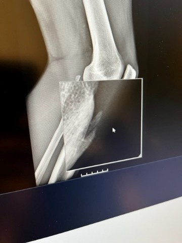 knee_two.jpg