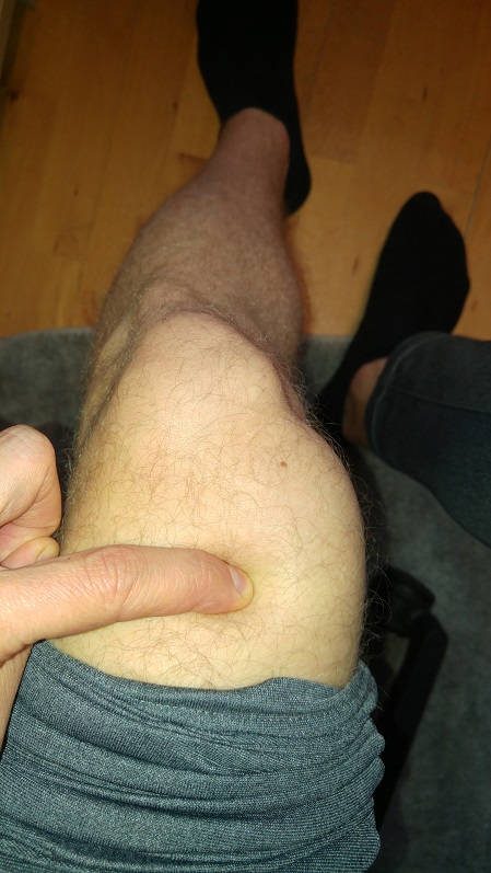 knee 2.jpg
