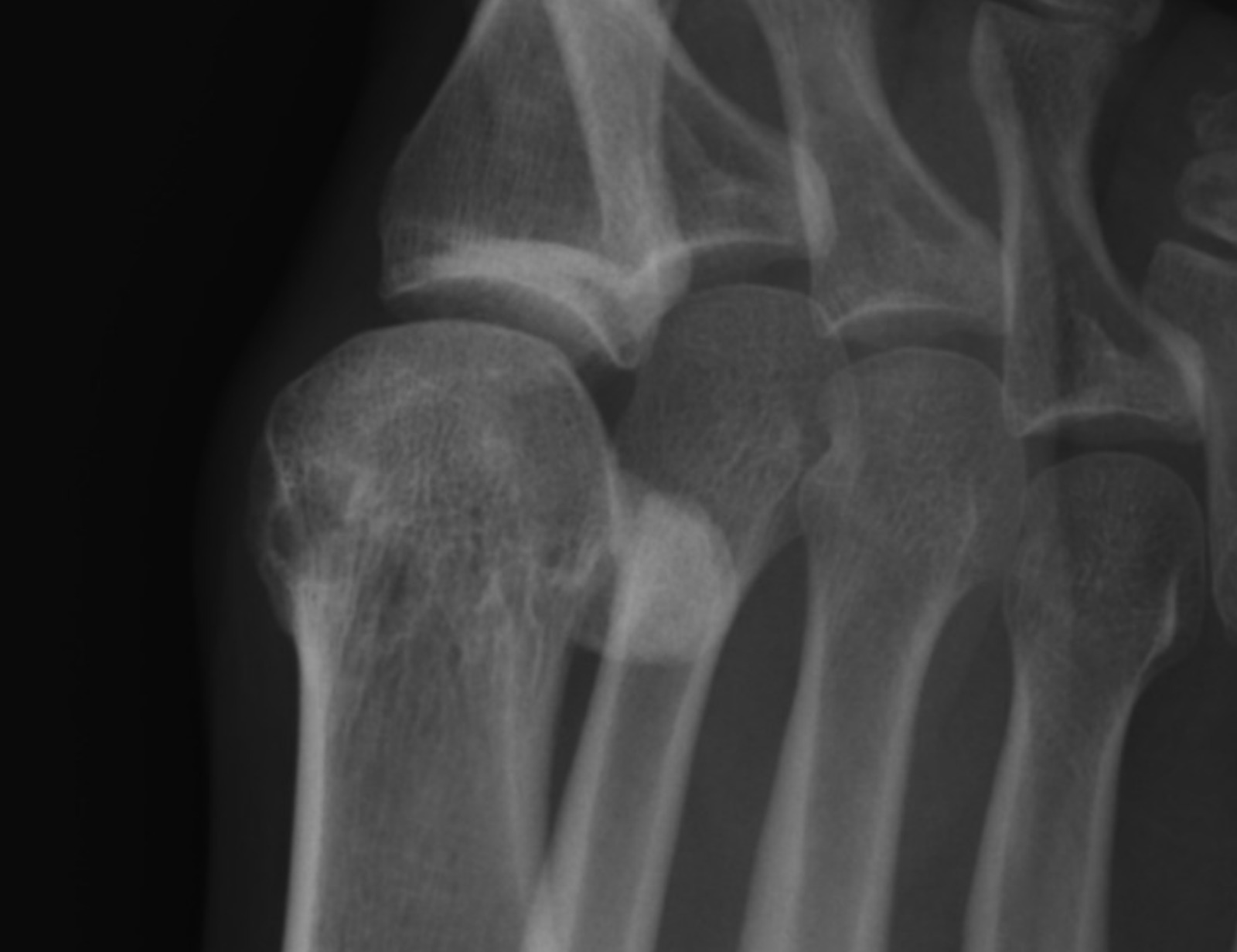 foot2.jpg