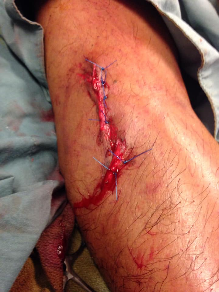 injury 1.jpg
