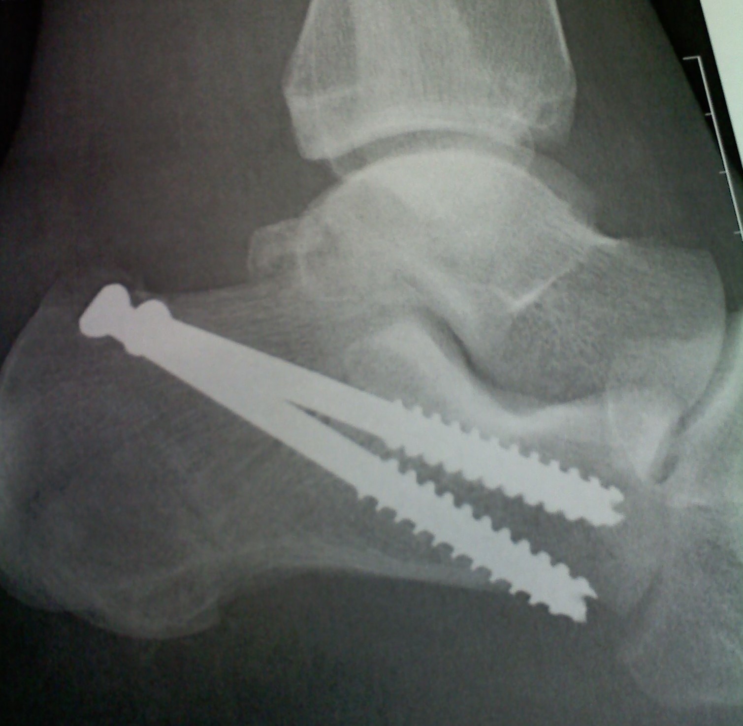 20120402122621_Crop.jpg